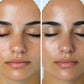 Ice Cool Skin Bowl | Skin Tightening | Ice Therapy